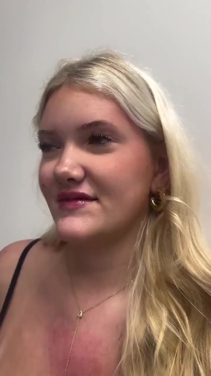Lip Filler video