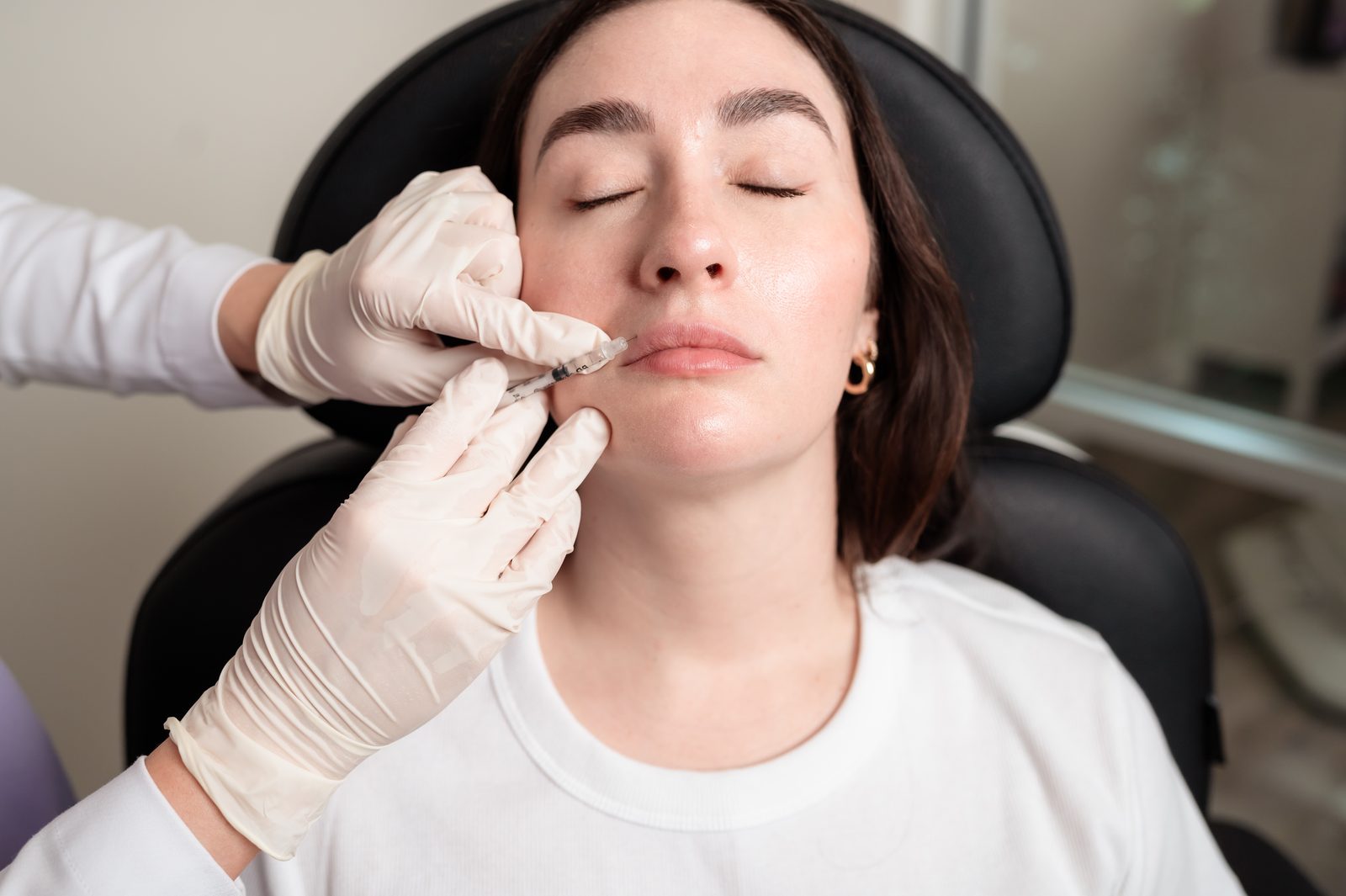 Lip Filler