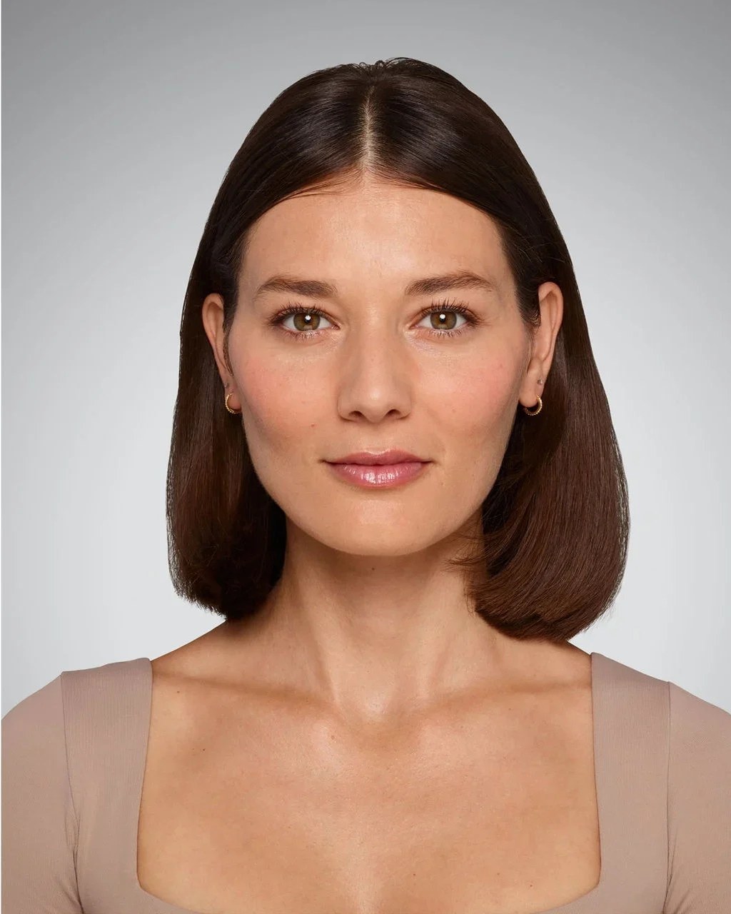 After Lip Filler
