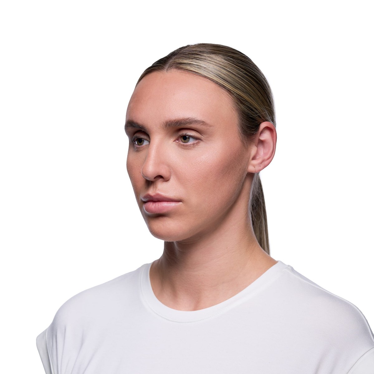 After Lip Filler