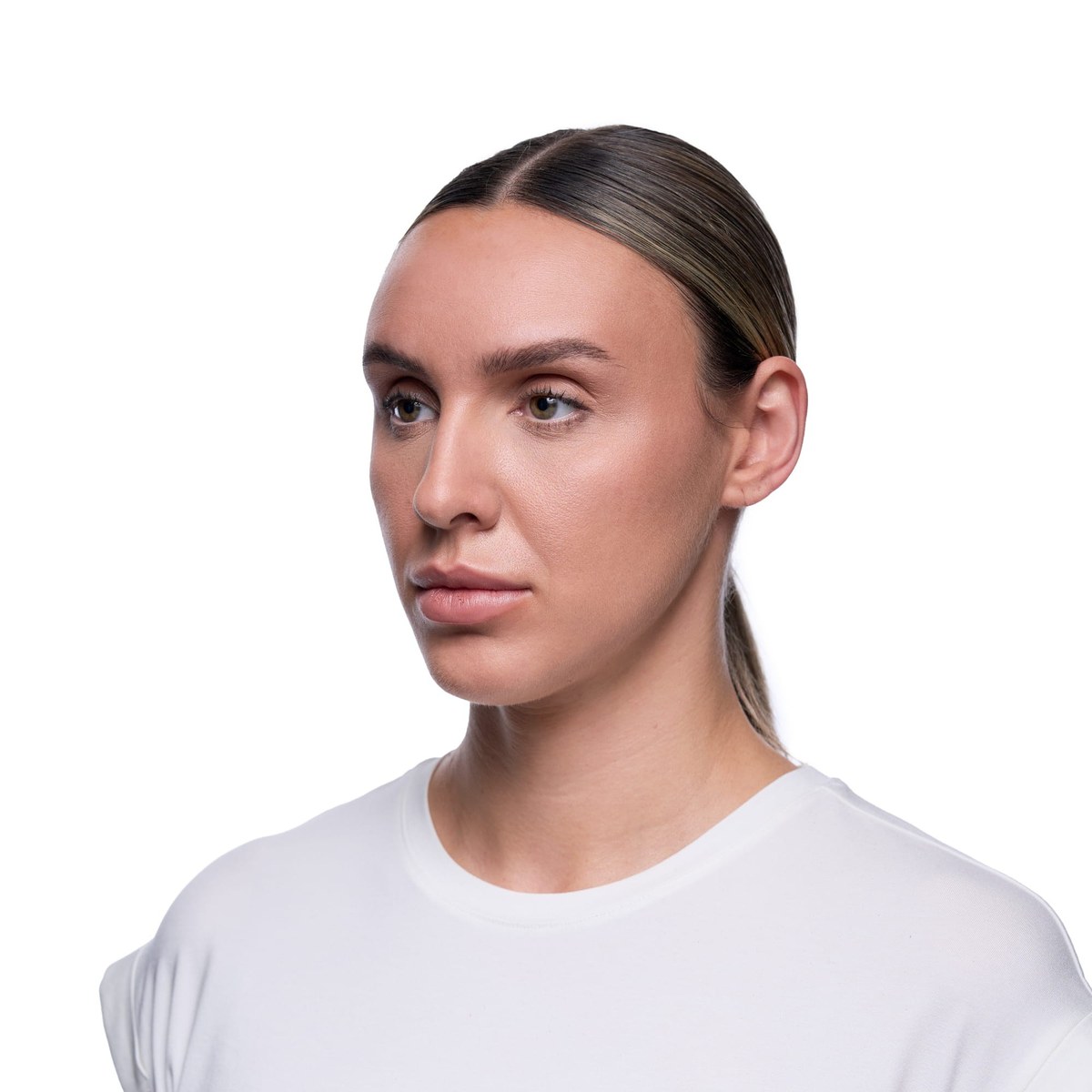 Before Lip Filler