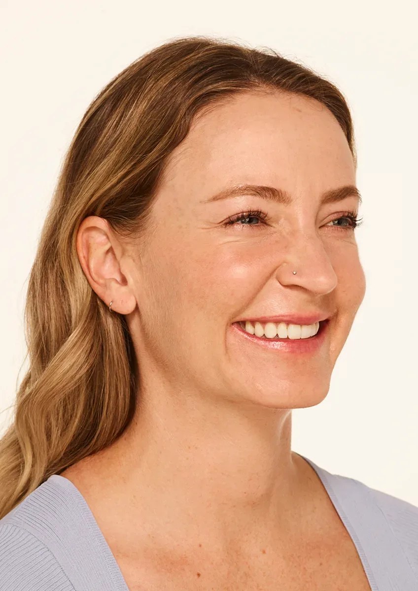 Before Wrinkle Relaxers