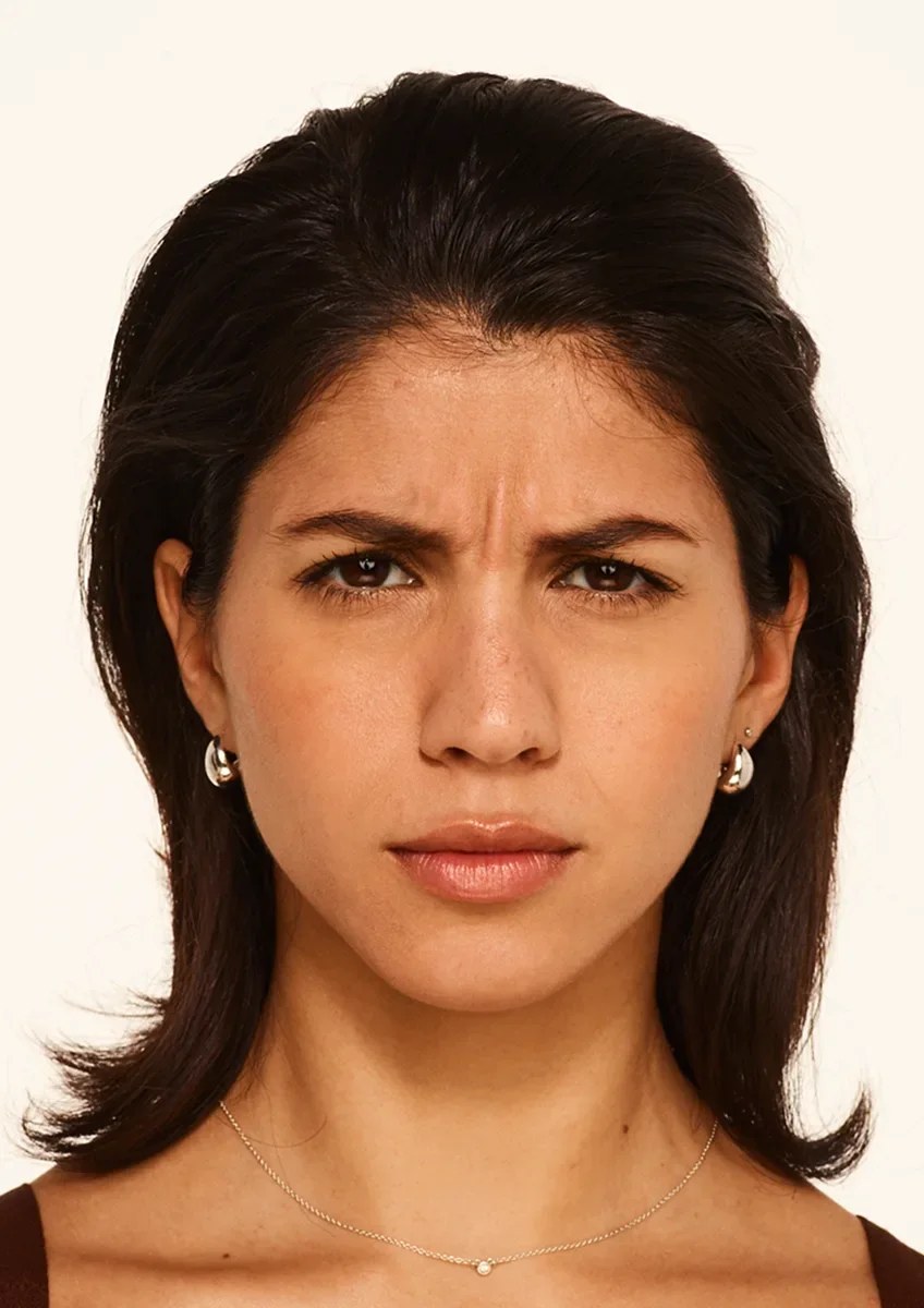 Before Wrinkle Relaxers