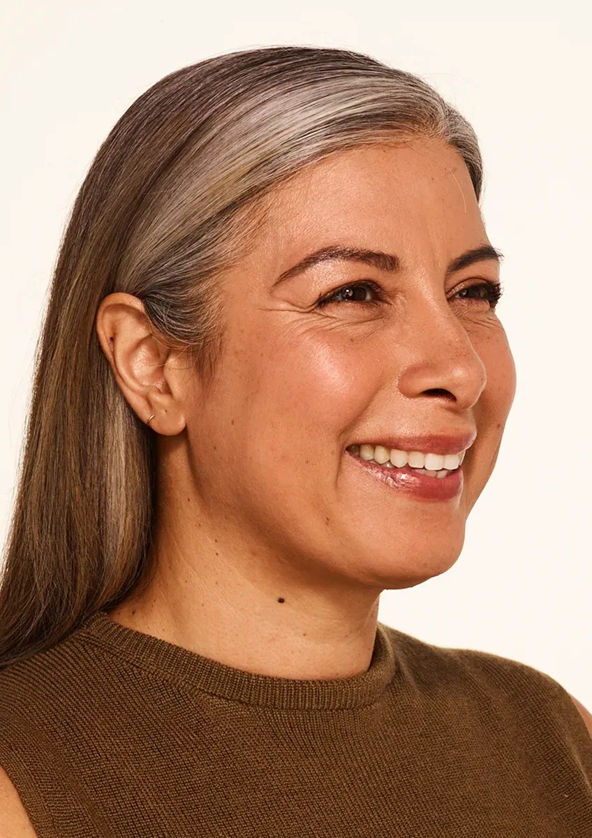 Before Wrinkle Relaxers